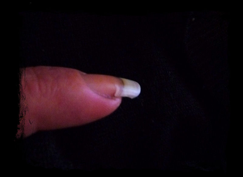 Ongle Fendu Beaute Des Ongles Forum Beaute