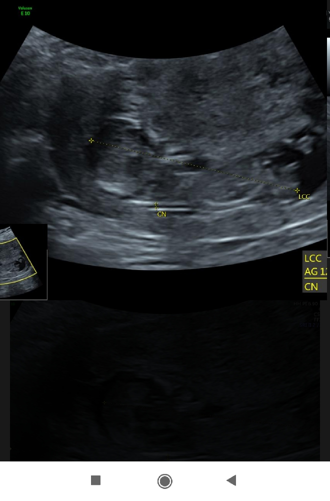 Bebe Juillet 21 Grossesse Forum Grossesse Amp Bebe Doctissimo