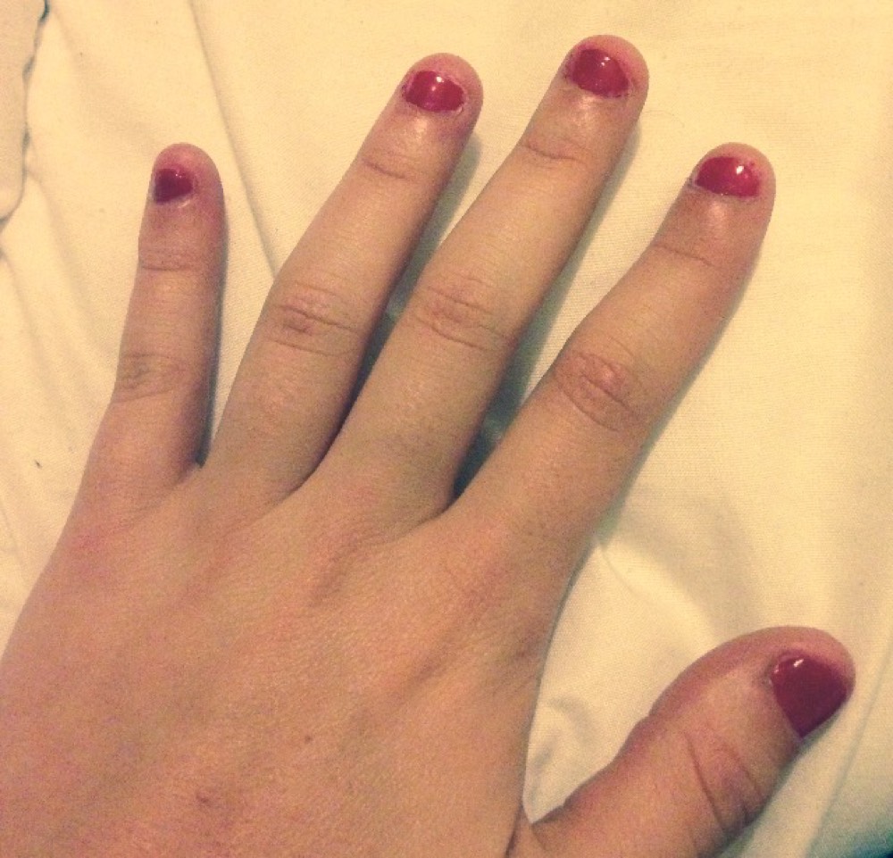 Stop Ongles Rongés Qui Me Suit Beauté Des Ongles