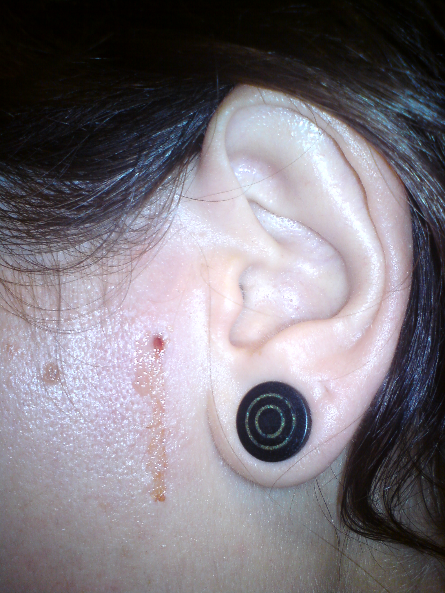 Microdermal Et Questions Tatouages Et Piercings Forum Beaute Doctissimo Microdermal Et Questions Tatouages Et Piercings Forum Beaute Doctissimo