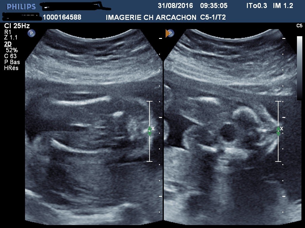 Doute Sur Le Sexe 21 Sa 5 Echographie Connaitre Le Sexe De Votre Bebe Forum Grossesse Amp Bebe Doctissimo Doute Sur Le Sexe 21 Sa 5 Echographie Connaitre Le Sexe De Votre Bebe Forum Grossesse Amp Bebe Doctissimo