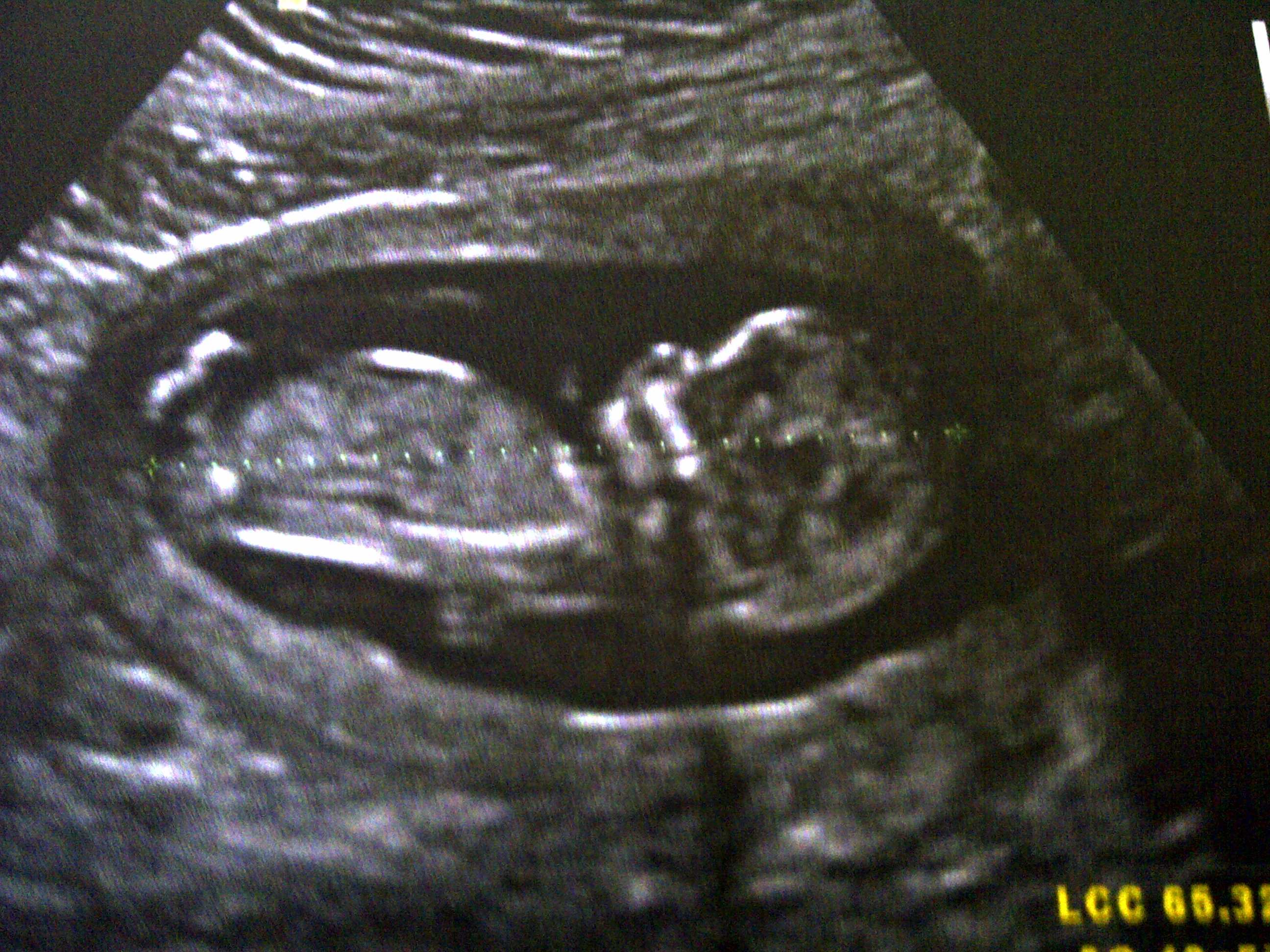 Enceinte De 4mois Echographie Connaitre Le Sexe De Votre Bebe Forum Grossesse Amp Bebe Doctissimo Enceinte De 4mois Echographie Connaitre Le Sexe De Votre Bebe Forum Grossesse Amp Bebe Doctissimo