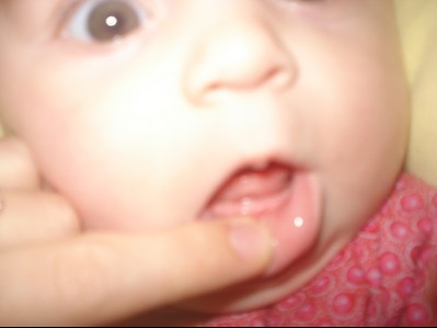 Recap Des 1eres Dents Par Ici Bebe Grandit Forum Grossesse Amp Bebe Doctissimo Recap Des 1eres Dents Par Ici Bebe Grandit Forum Grossesse Amp Bebe Doctissimo