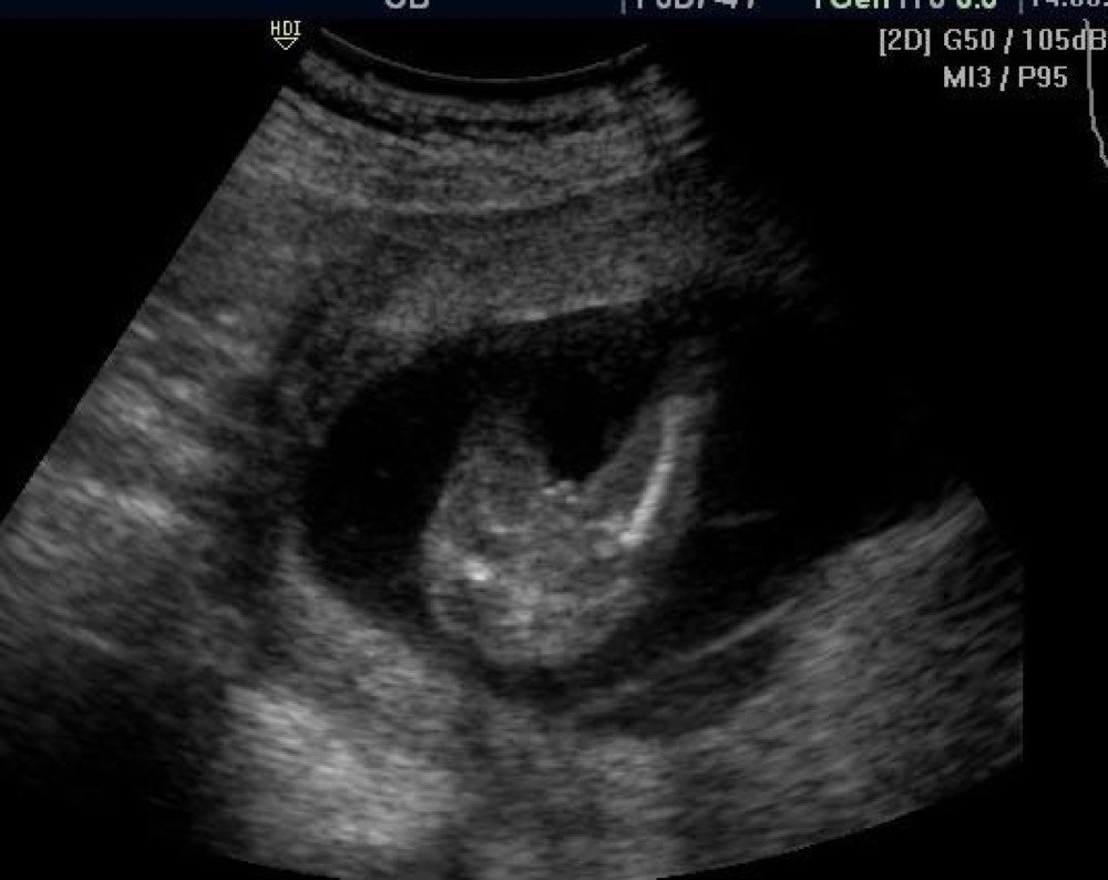 Sex Echo 16sa Echographie Connaitre Le Sexe De Votre Bebe Forum Grossesse Amp Bebe Doctissimo Sex Echo 16sa Echographie Connaitre Le Sexe De Votre Bebe Forum Grossesse Amp Bebe Doctissimo