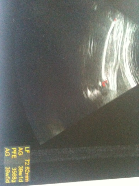 Poids Du Foetus A 37sa Et 6 Jours Futures Mamans Forum Grossesse Amp Bebe Doctissimo Poids Du Foetus A 37sa Et 6 Jours Futures Mamans Forum Grossesse Amp Bebe Doctissimo