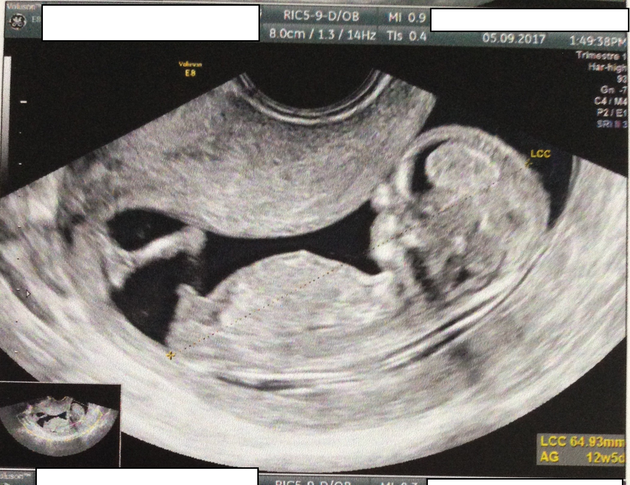 Avis Sexe Echo 12 Sa Echographie Connaitre Le Sexe De Votre Bebe Forum Grossesse Amp Bebe Doctissimo Avis Sexe Echo 12 Sa Echographie Connaitre Le Sexe De Votre Bebe Forum Grossesse Amp Bebe Doctissimo