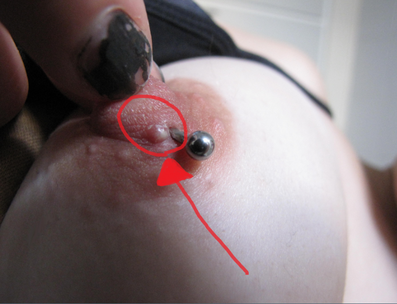 À l'aide!! piercing tétonsinfection?! - tatouages et piercings