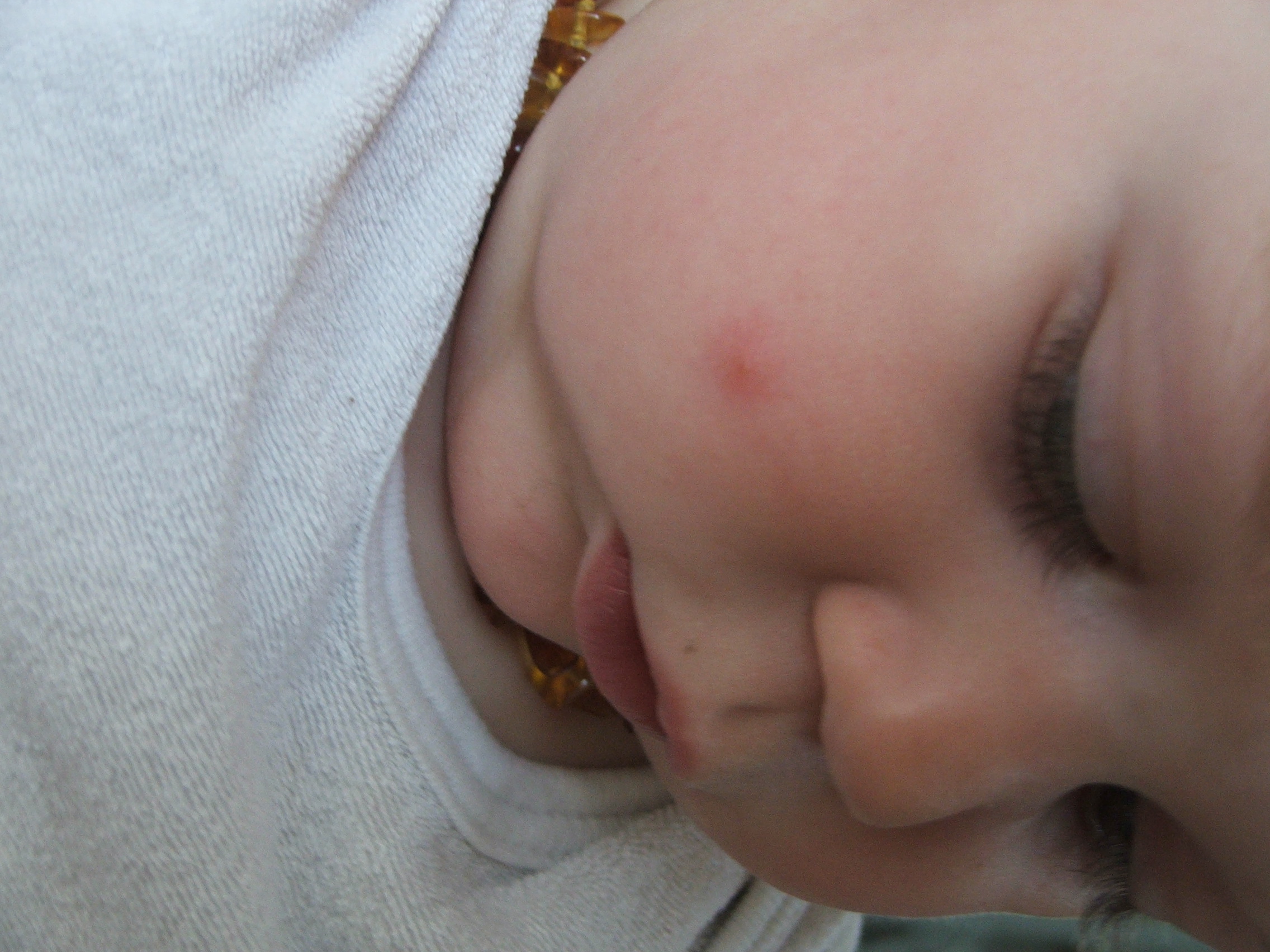 Ah Ces Moustiques Bebe Grandit Forum Grossesse Amp Bebe Doctissimo