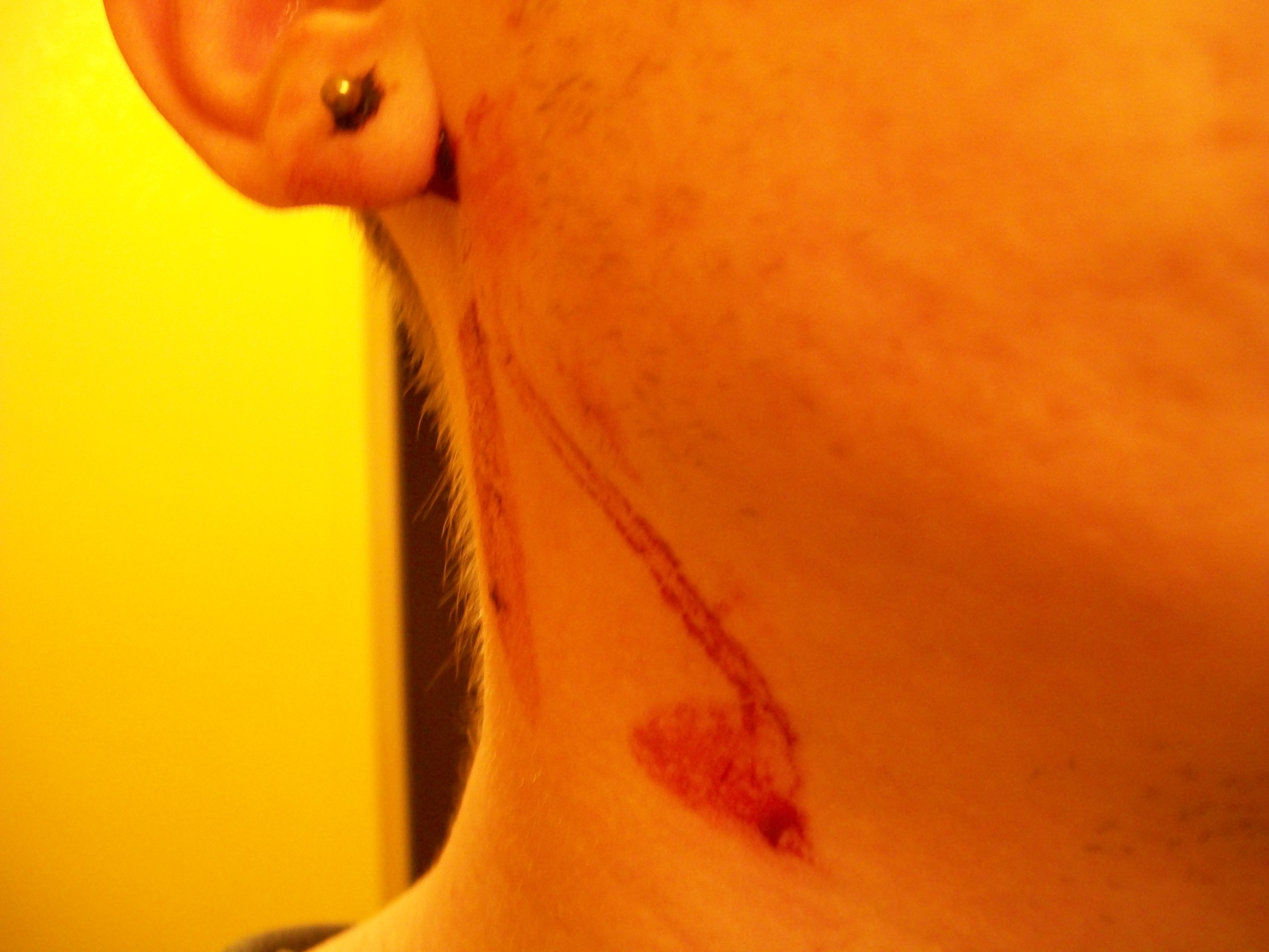 Lobe Et Saignement Tatouages Et Piercings Forum Beaute