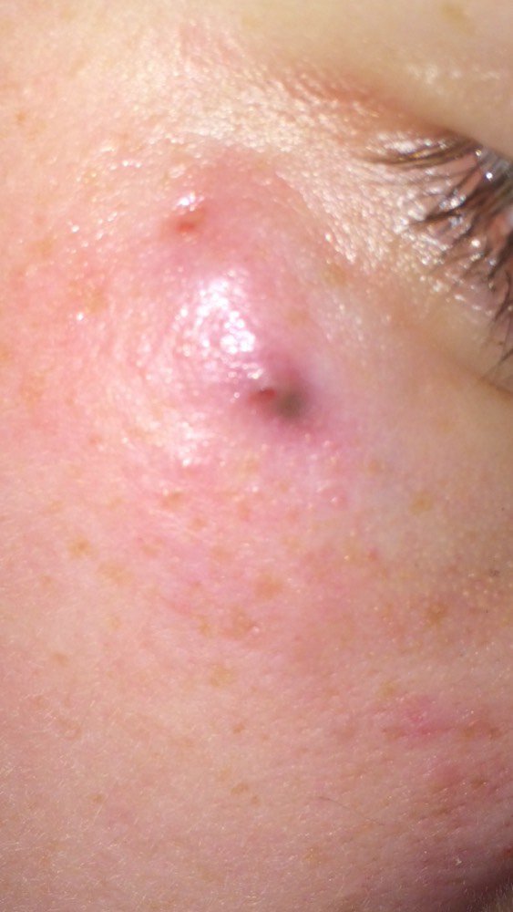 Probleme A Mon Oeil De Chat Piercing Tatouages Et Piercings Forum Beaute Doctissimo Probleme A Mon Oeil De Chat Piercing Tatouages Et Piercings Forum Beaute Doctissimo