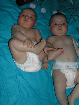 Les Grosses Joues C Est Par Ici Photos Jumeaux Triples Et Plus Forum Grossesse Amp Bebe Doctissimo