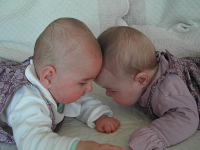 Les Grosses Joues C Est Par Ici Photos Jumeaux Triples Et Plus Forum Grossesse Amp Bebe Doctissimo