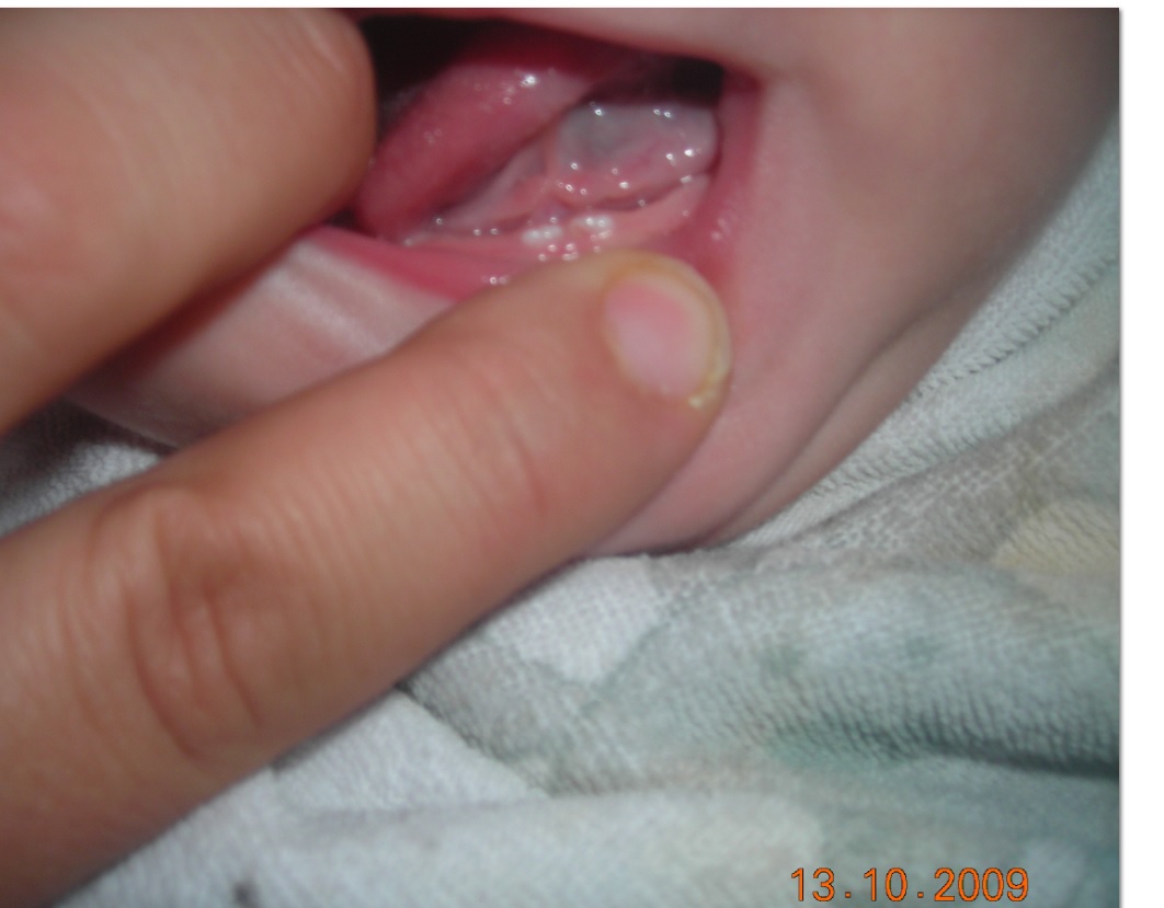 Les Dents Bebe Grandit Forum Grossesse Amp Bebe Doctissimo Les Dents Bebe Grandit Forum Grossesse Amp Bebe Doctissimo