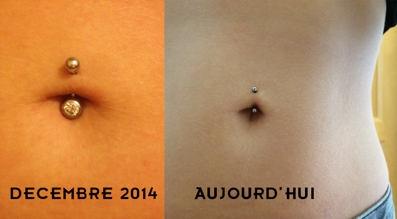 Rejet Nombril Avis Tatouages Et Piercings Forum Beaute Doctissimo