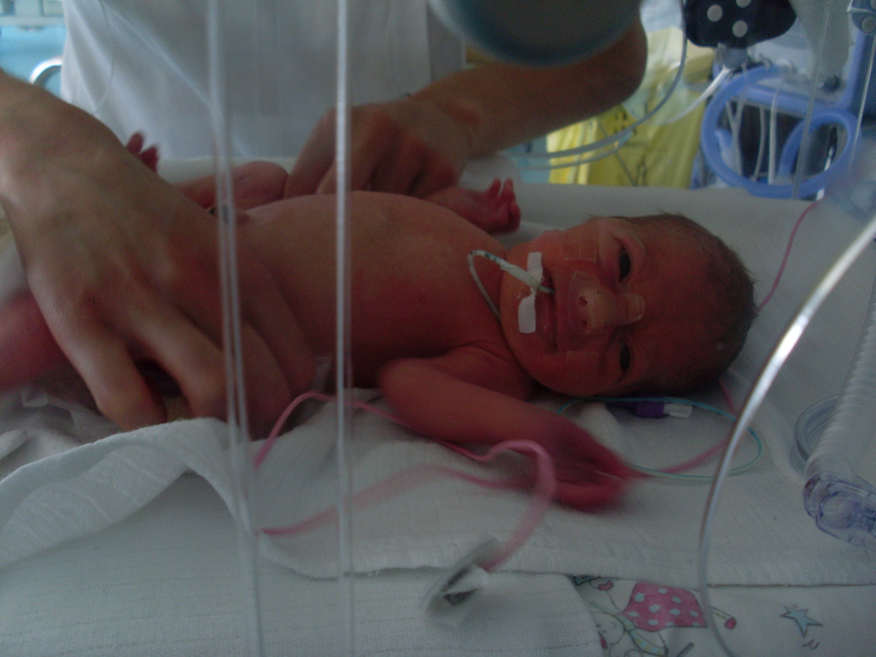 Futur Prema Besoin De Vos Temoignages Zoe Est Arrivee A 30sa 2 Page 3 Prematures Forum Grossesse Amp Bebe Doctissimo Futur Prema Besoin De Vos Temoignages Zoe Est Arrivee A 30sa 2 Page 3 Prematures Forum Grossesse Amp Bebe Doctissimo