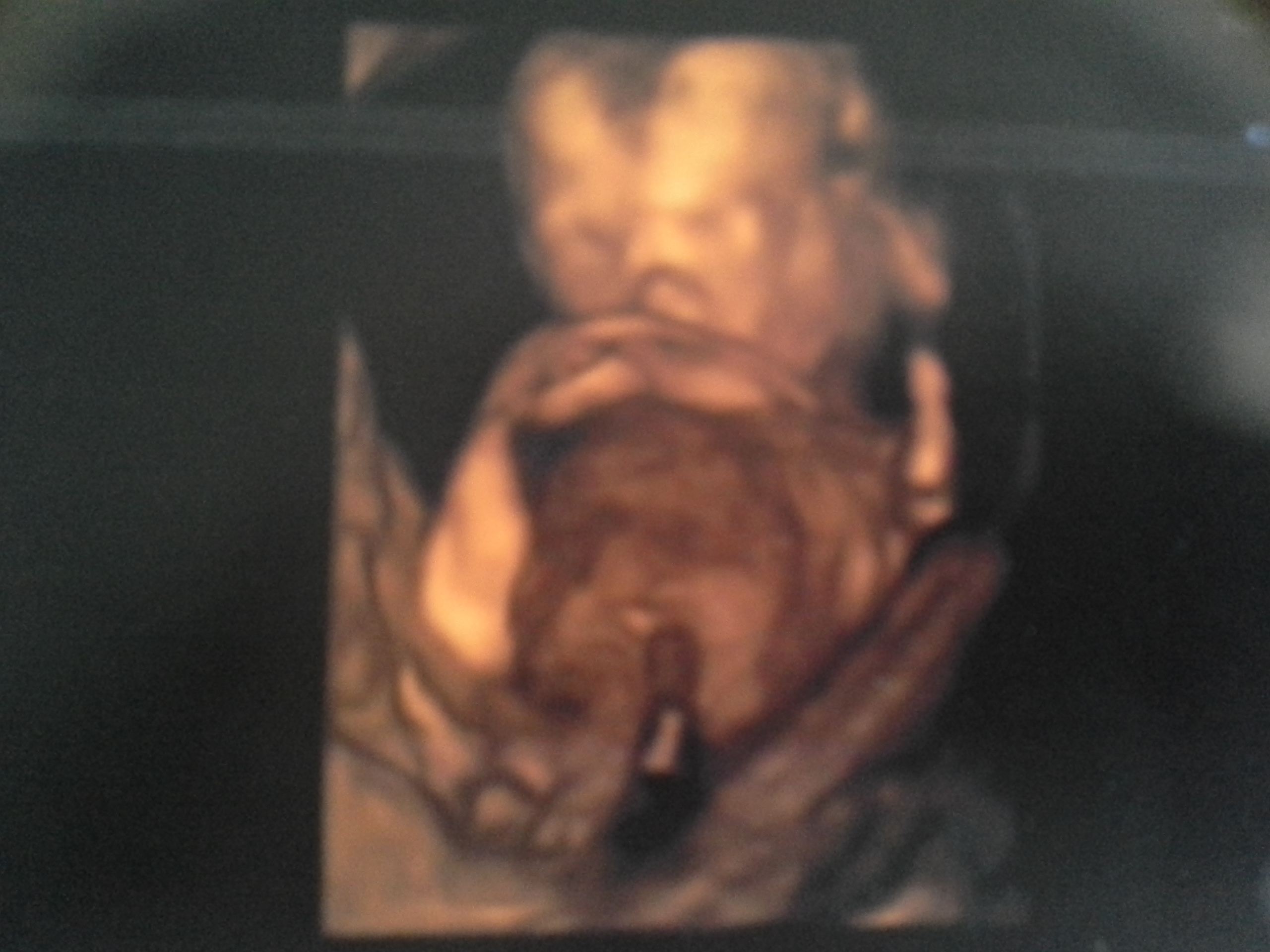 Echo 3d 3mois Et Une Semaine Qu En Pensez Vous Echographie Connaitre Le Sexe De Votre Bebe Forum Grossesse Amp Bebe Doctissimo Echo 3d 3mois Et Une Semaine Qu En Pensez Vous Echographie Connaitre Le Sexe De Votre Bebe Forum Grossesse Amp Bebe Doctissimo