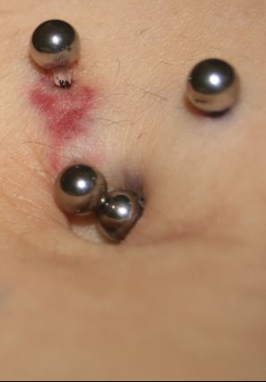 Piercing Nombril Infection Rejet Ou Seulement Inquietude Tatouages Et Piercings Forum Beaute Doctissimo Piercing Nombril Infection Rejet Ou Seulement Inquietude Tatouages Et Piercings Forum Beaute Doctissimo