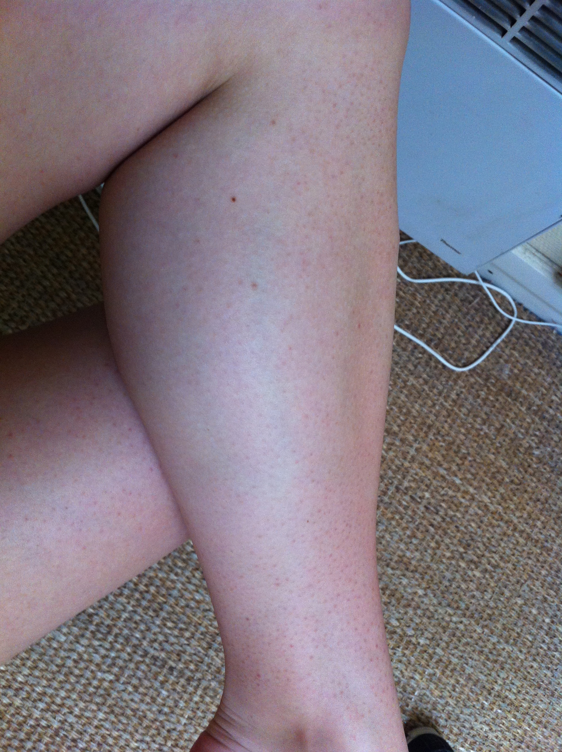 Jambes Beaute De La Peau Forum Beaute Doctissimo