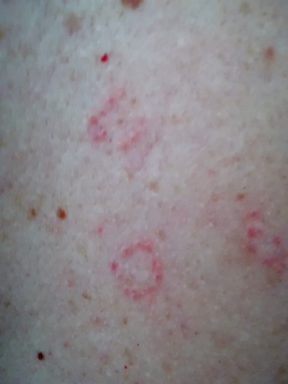 bouton en forme de cercle