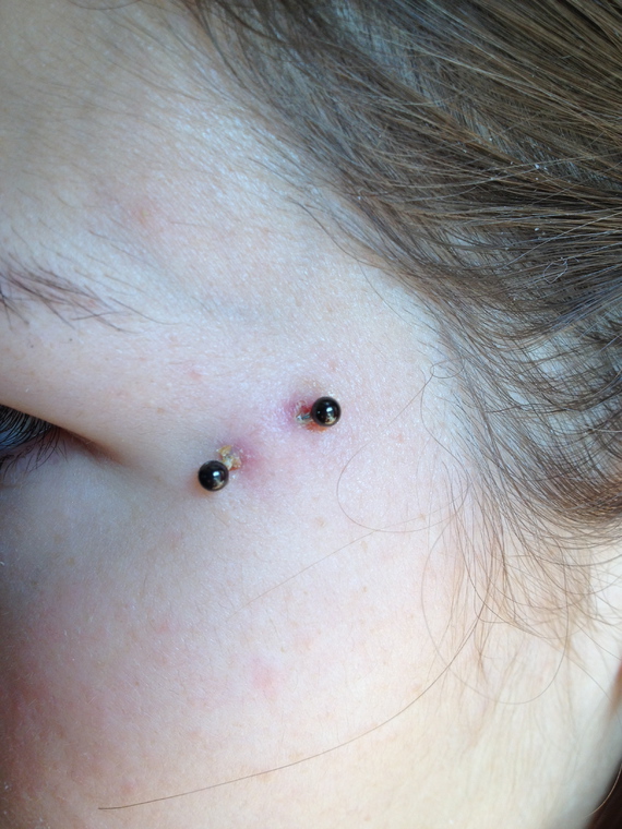 Piercing Oeil De Chat Rejet Piercing Oeil De Chat Rejet