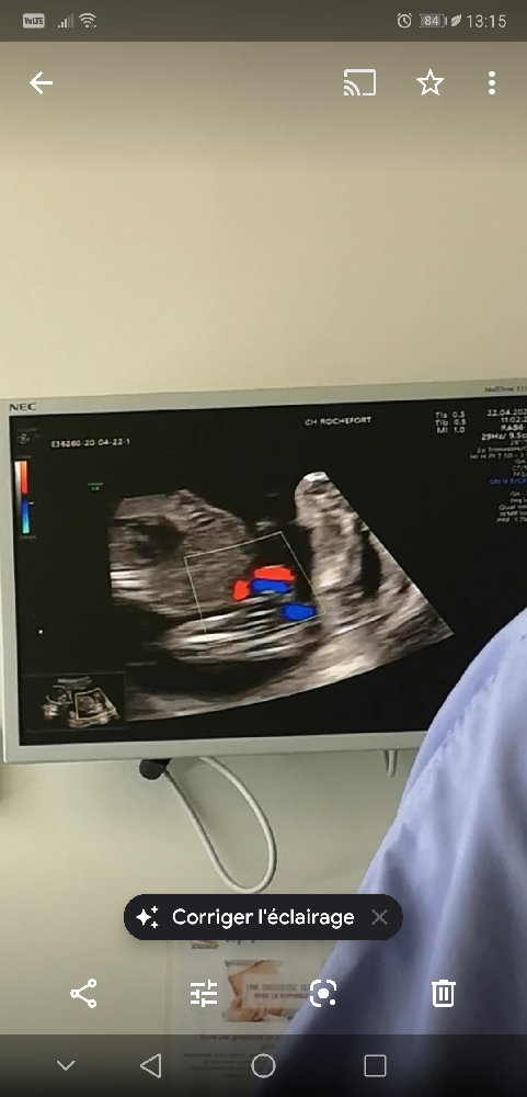 Mal Position De Bebe Pour Le Sexe Echographie Connaitre Le Sexe De Votre Bebe Forum Grossesse Amp Bebe Doctissimo Mal Position De Bebe Pour Le Sexe Echographie Connaitre Le Sexe De Votre Bebe Forum Grossesse Amp Bebe Doctissimo