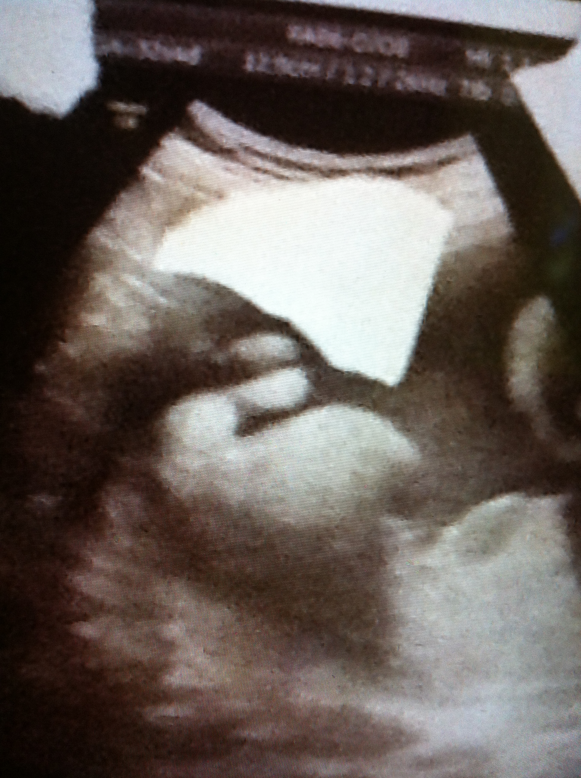 Echo 32sa Sexe De Bebe En Gros Plan Fille Ou Garcon Svp Echographie Connaitre Le Sexe De Votre Bebe Forum Grossesse Amp Bebe Doctissimo Echo 32sa Sexe De Bebe En Gros Plan Fille Ou Garcon Svp Echographie Connaitre Le Sexe De Votre Bebe Forum Grossesse Amp Bebe Doctissimo