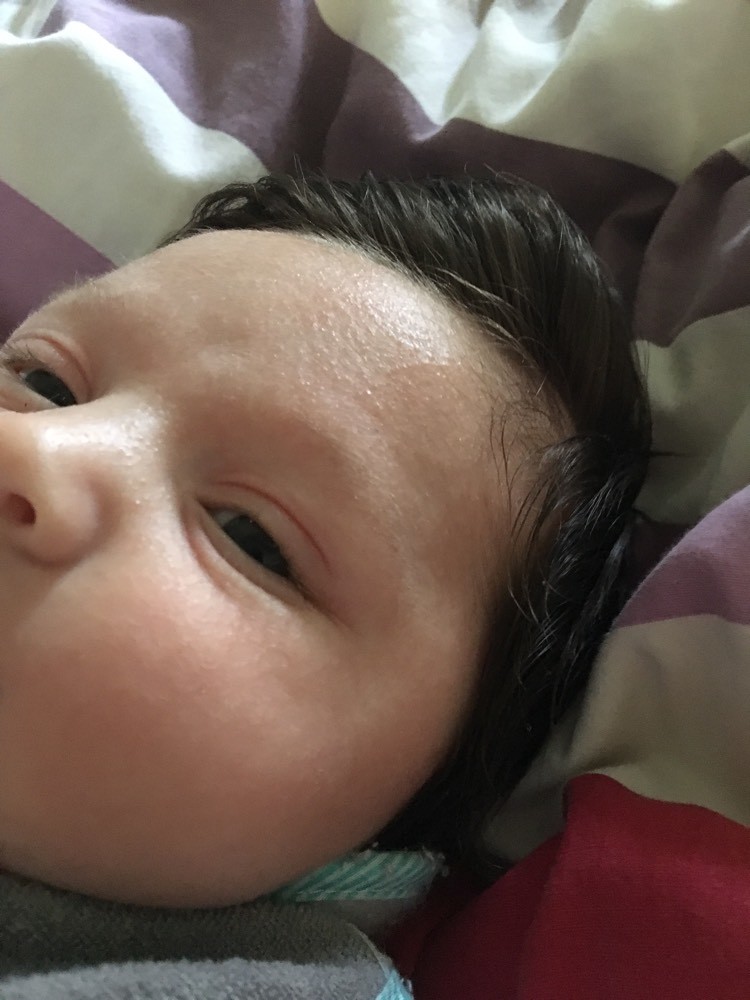 Peau Granuleuse Bebe De 2 Mois Sante De L Enfant Forum Sante Doctissimo Peau Granuleuse Bebe De 2 Mois Sante De L Enfant Forum Sante Doctissimo