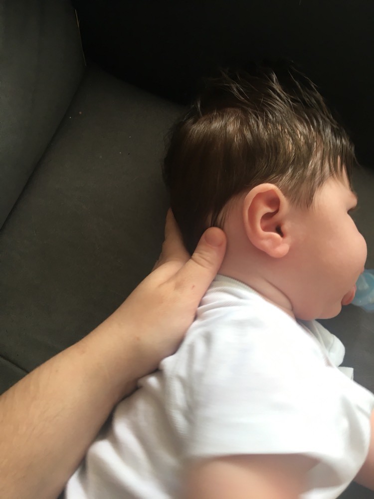 Bebe 3 Mois Tete Plate Sante De L Enfant Forum Sante Doctissimo Bebe 3 Mois Tete Plate Sante De L Enfant Forum Sante Doctissimo