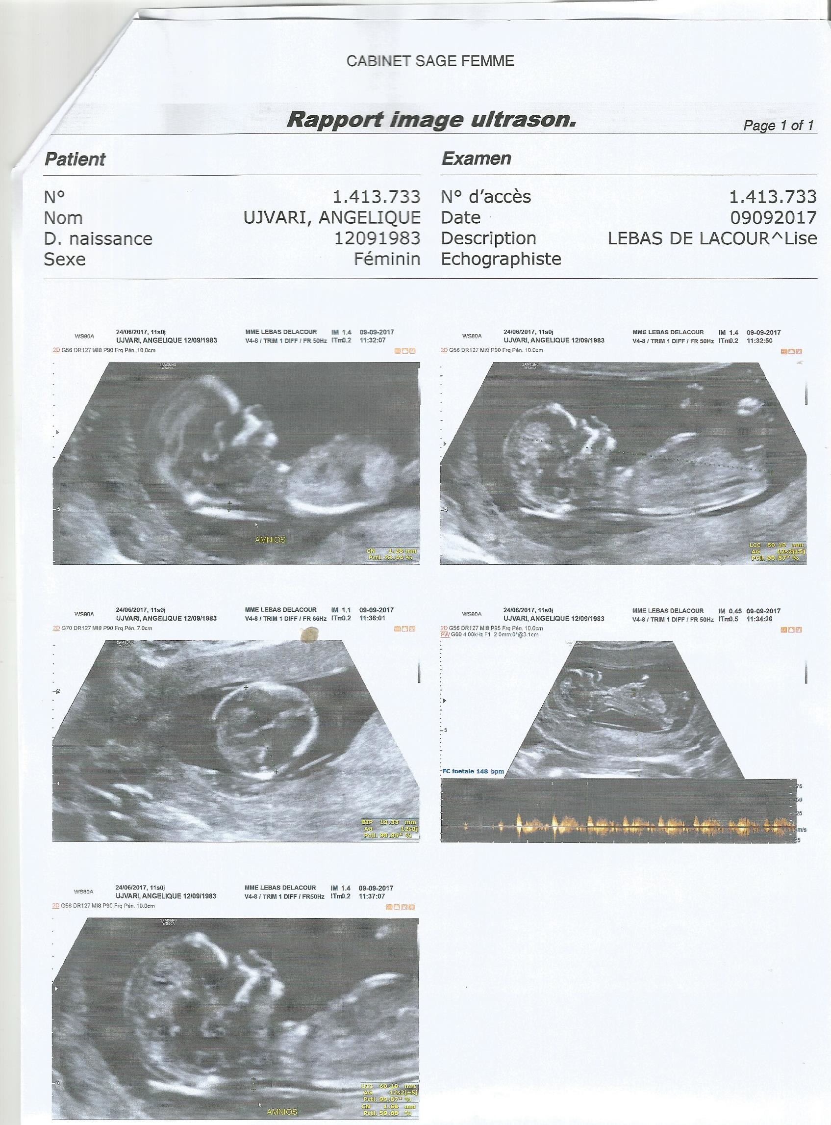 Avis Echo Fille Ou Garcons Echographie Forum Grossesse Bebe