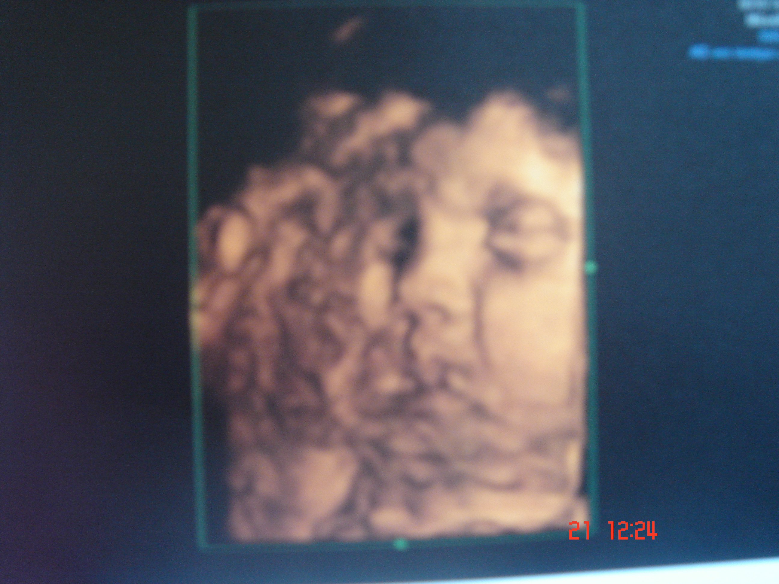 Mon Echo En 4d M Obsede Echographie Connaitre Le Sexe De Votre Bebe Forum Grossesse Amp Bebe Doctissimo Mon Echo En 4d M Obsede Echographie Connaitre Le Sexe De Votre Bebe Forum Grossesse Amp Bebe Doctissimo