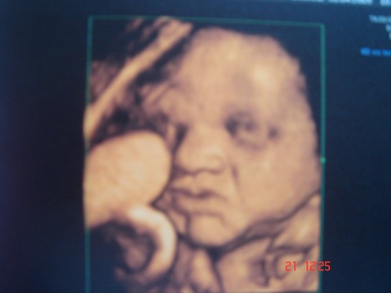 Photo Echo 3d Vraiment Ressemblant Photo Echo 3d Vraiment Ressemblant