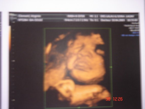 Mon Echo En 4d M Obsede