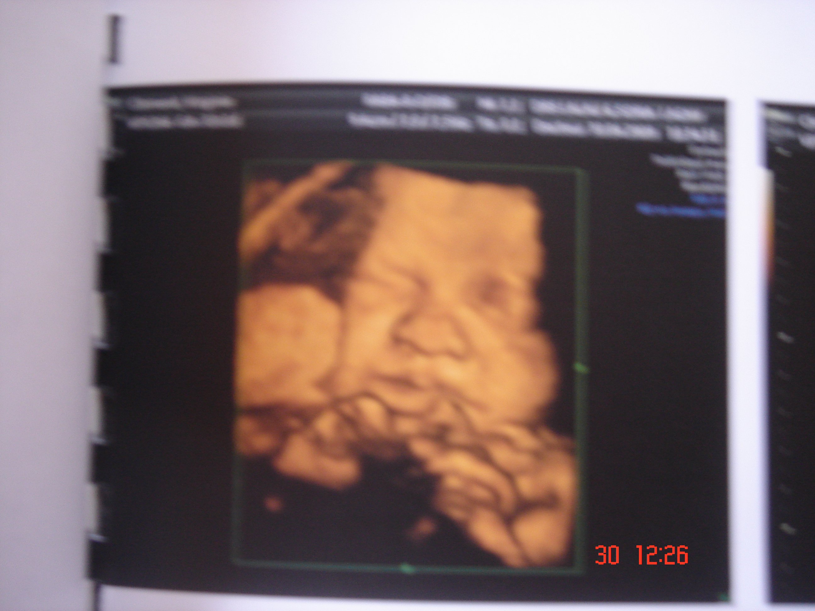 Photo Echo 3d Vraiment Ressemblant Forum Libre Grossesse Et Bebe Forum Grossesse Amp Bebe Doctissimo Photo Echo 3d Vraiment Ressemblant Forum Libre Grossesse Et Bebe Forum Grossesse Amp Bebe Doctissimo