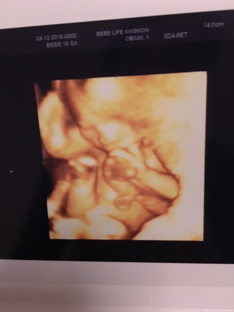 Une Idee Sexe Bebe 18sa Echographie Connaitre Le Sexe De Votre Bebe Forum Grossesse Amp Bebe Doctissimo Une Idee Sexe Bebe 18sa Echographie Connaitre Le Sexe De Votre Bebe Forum Grossesse Amp Bebe Doctissimo