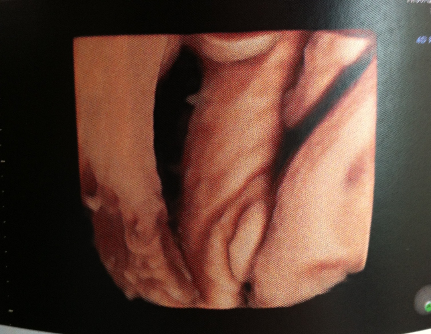 Besoin D Avis Sexe Bebe 4d A 32 Sa Svp Rajout De Photos Echographie Connaitre Le Sexe De Votre Bebe Forum Grossesse Amp Bebe Doctissimo Besoin D Avis Sexe Bebe 4d A 32 Sa Svp Rajout De Photos Echographie Connaitre Le Sexe De Votre Bebe Forum Grossesse Amp Bebe Doctissimo