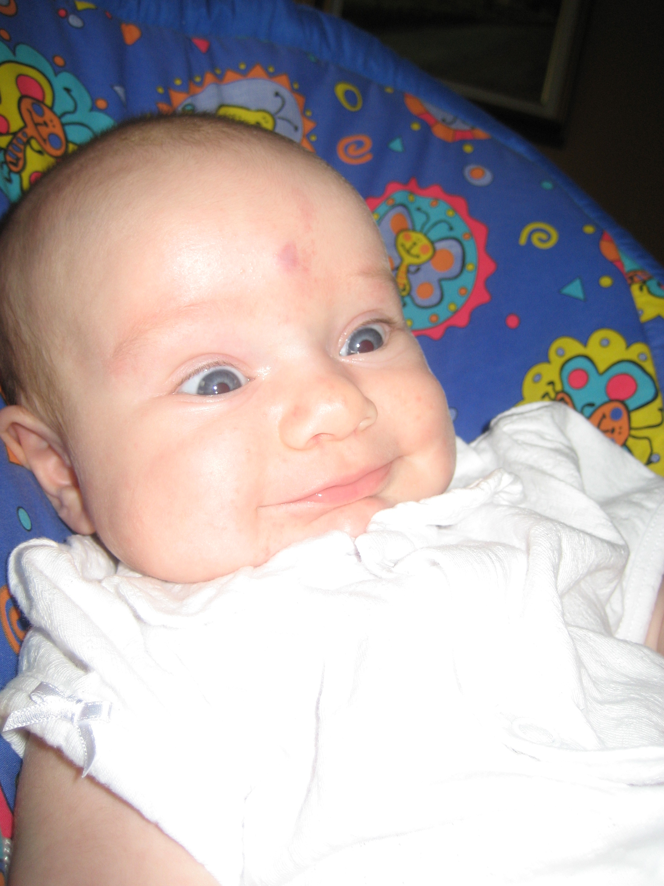 Angiome Sous Cutane Quelqu Un Connait Mamans Et Futures Mamans Du Quebec Forum Grossesse Amp Bebe Doctissimo