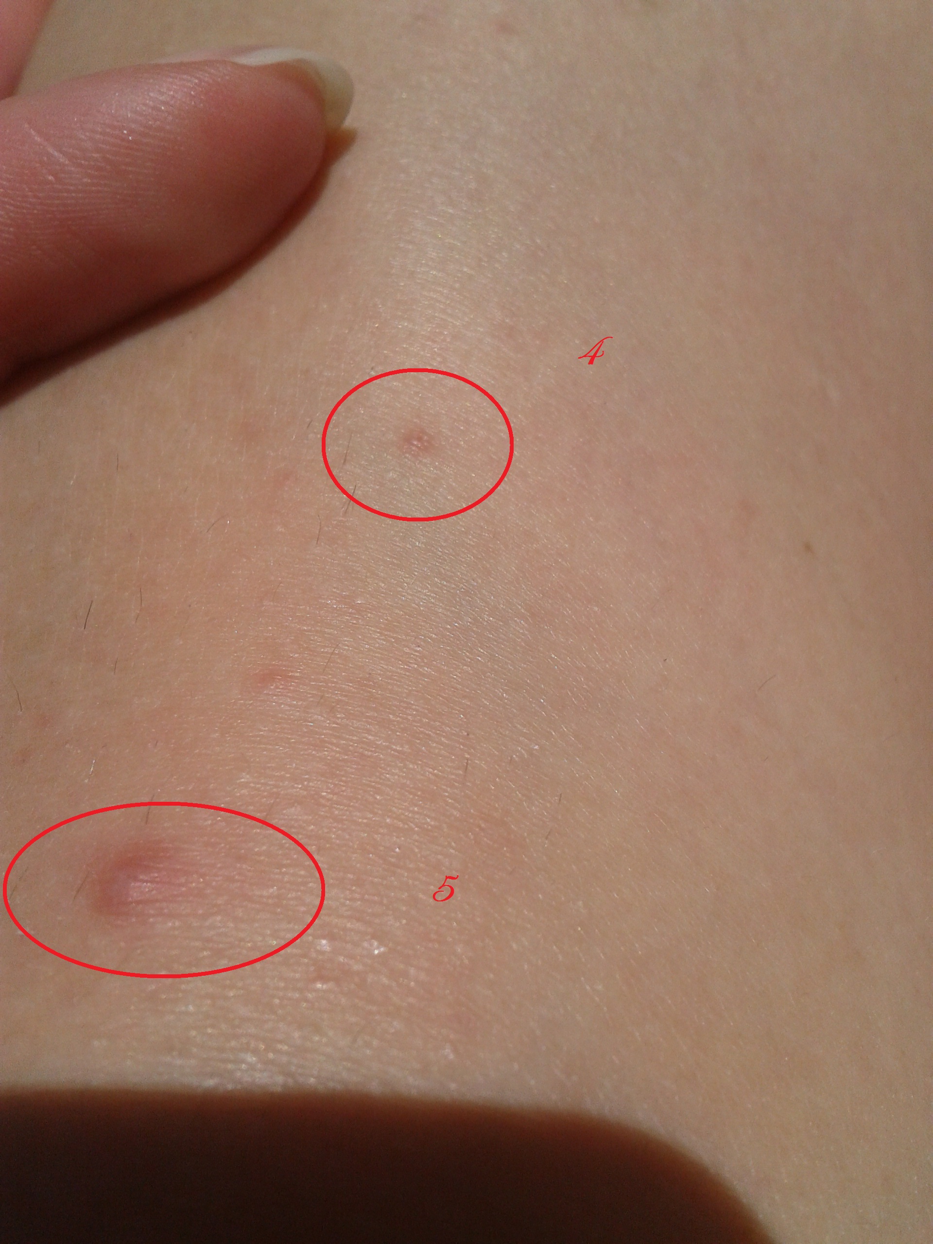 bouton repousse poil maillot