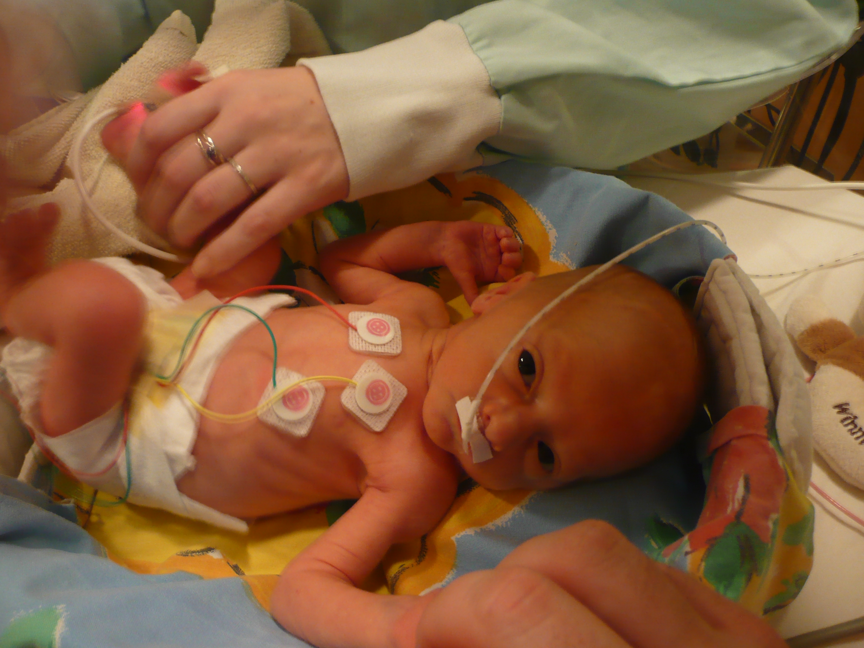 Photos Naissance Et 1 An Apres Bebes De L Annee Forum Grossesse Amp Bebe Doctissimo Photos Naissance Et 1 An Apres Bebes De L Annee Forum Grossesse Amp Bebe Doctissimo