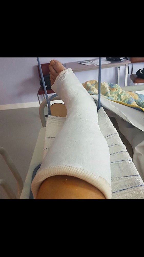 Conduire une voiture avec un pied platr Entorses et Conduire une voiture avec un pied platr Entorses et