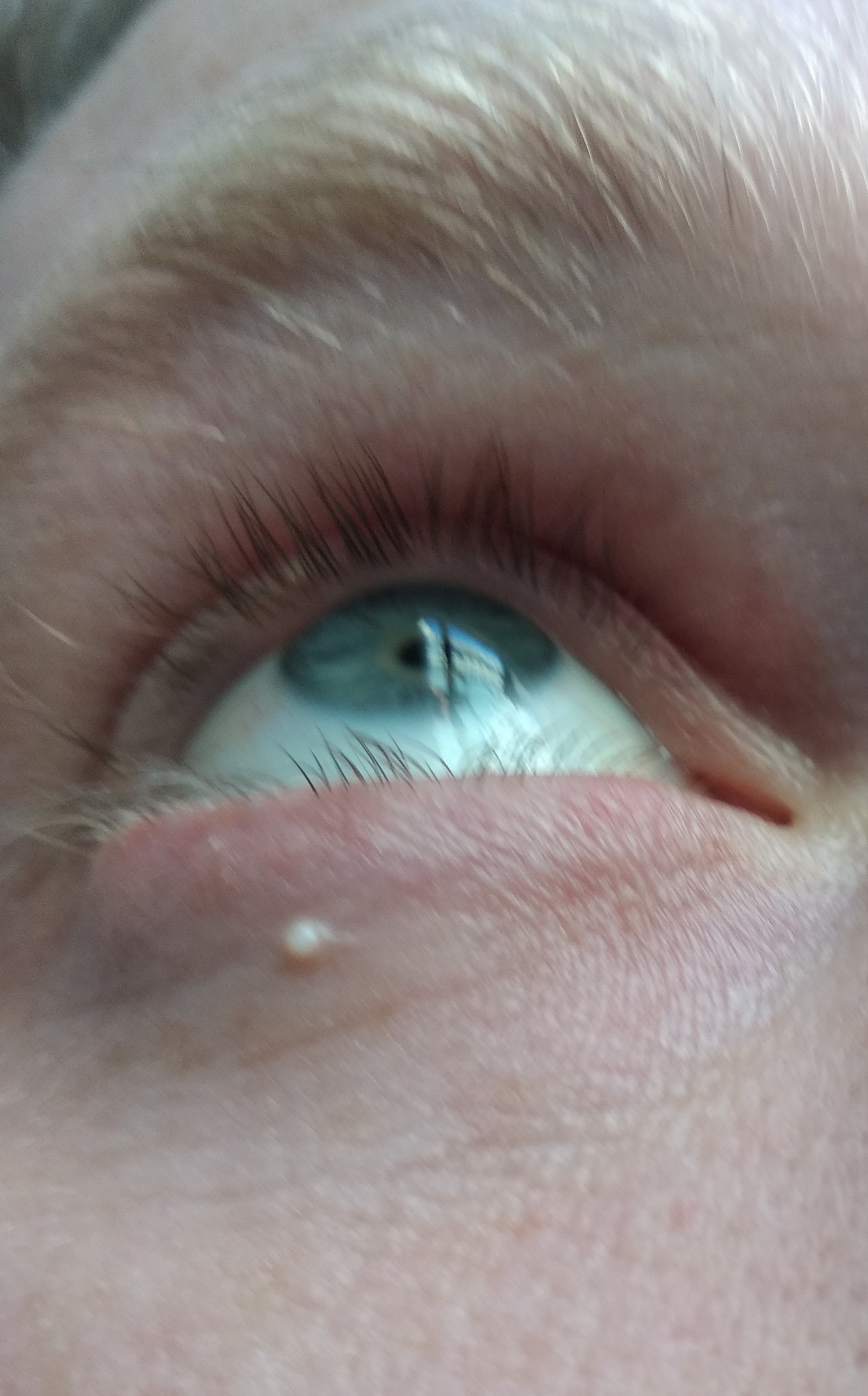 Img Bouton Blanc Oeil Vincent7691 Photos Club Doctissimo Img Bouton Blanc Oeil Vincent7691 Photos Club Doctissimo