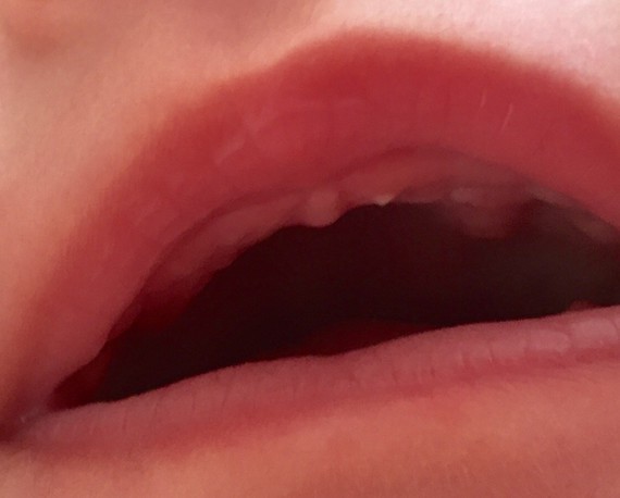 Dent Du Haut Qui Pousse En Premier Dent Du Haut Qui Pousse En Premier