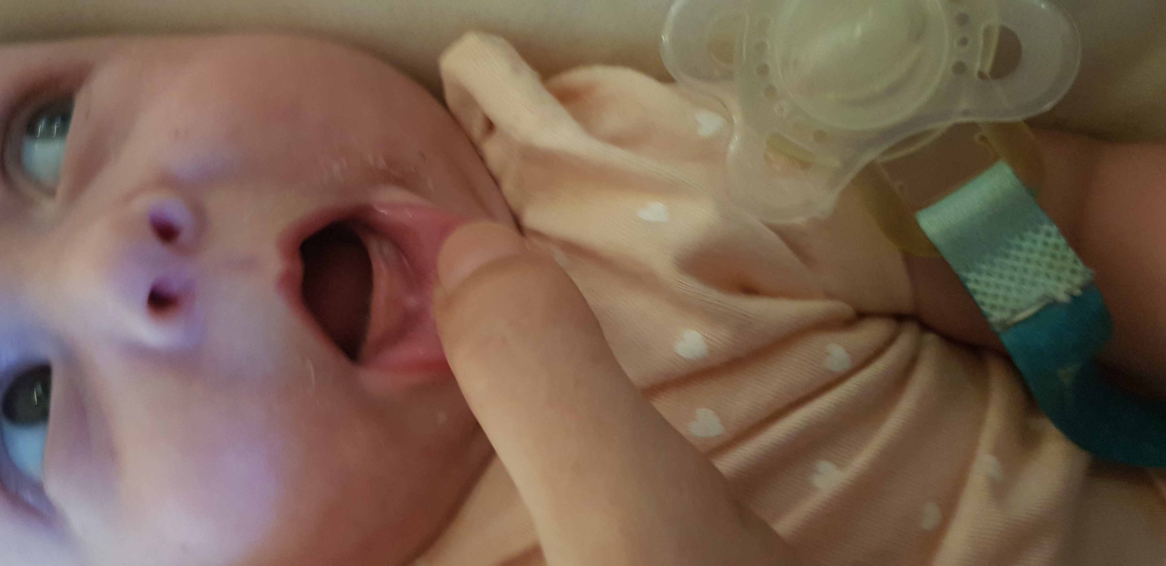 Dent Bebe 3 Mois Et Demi Sante De L Enfant Forum Sante Doctissimo Dent Bebe 3 Mois Et Demi Sante De L Enfant Forum Sante Doctissimo