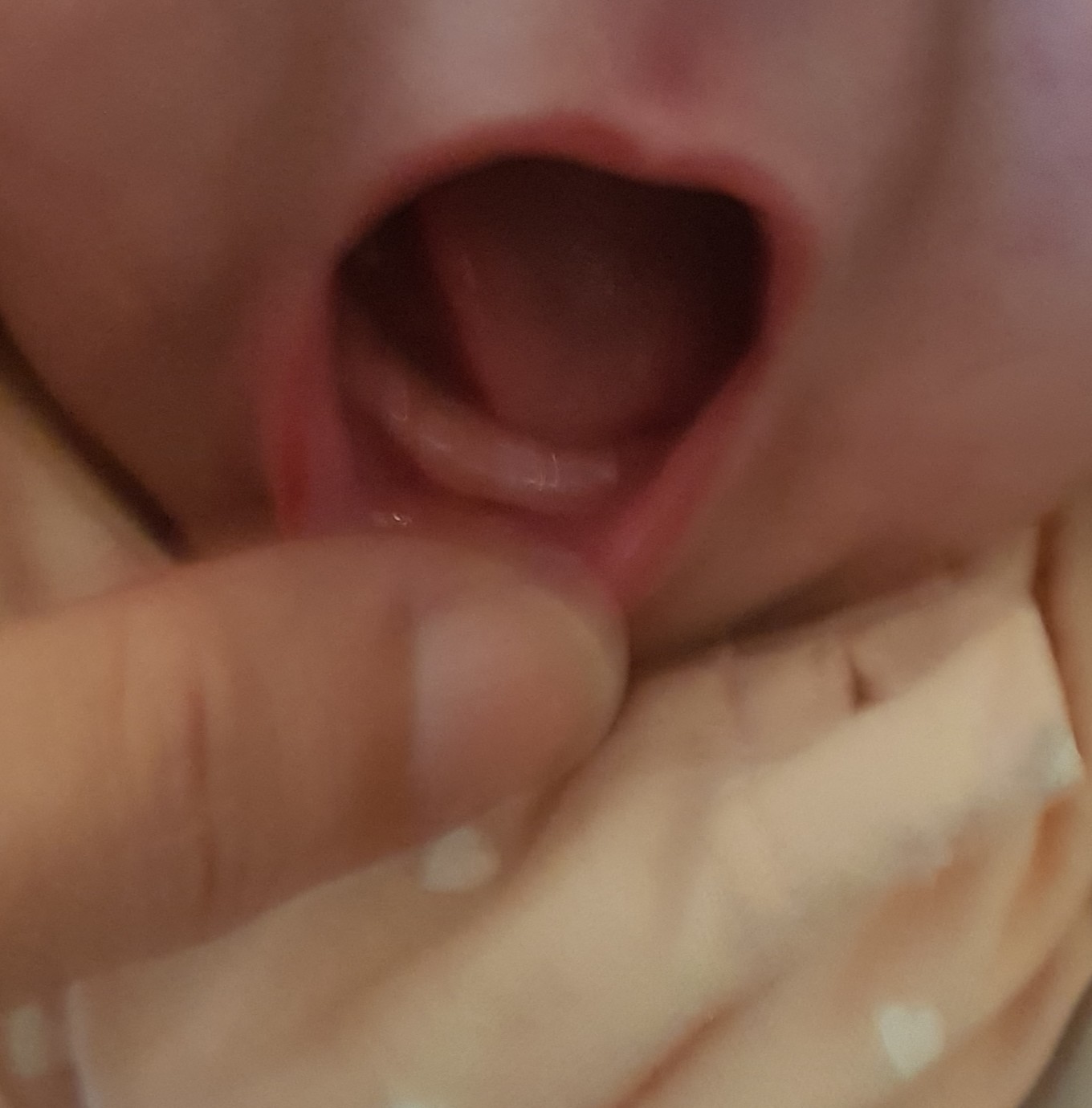 Dent Bebe 3 Mois Et Demi Sante De L Enfant Forum Sante Doctissimo Dent Bebe 3 Mois Et Demi Sante De L Enfant Forum Sante Doctissimo