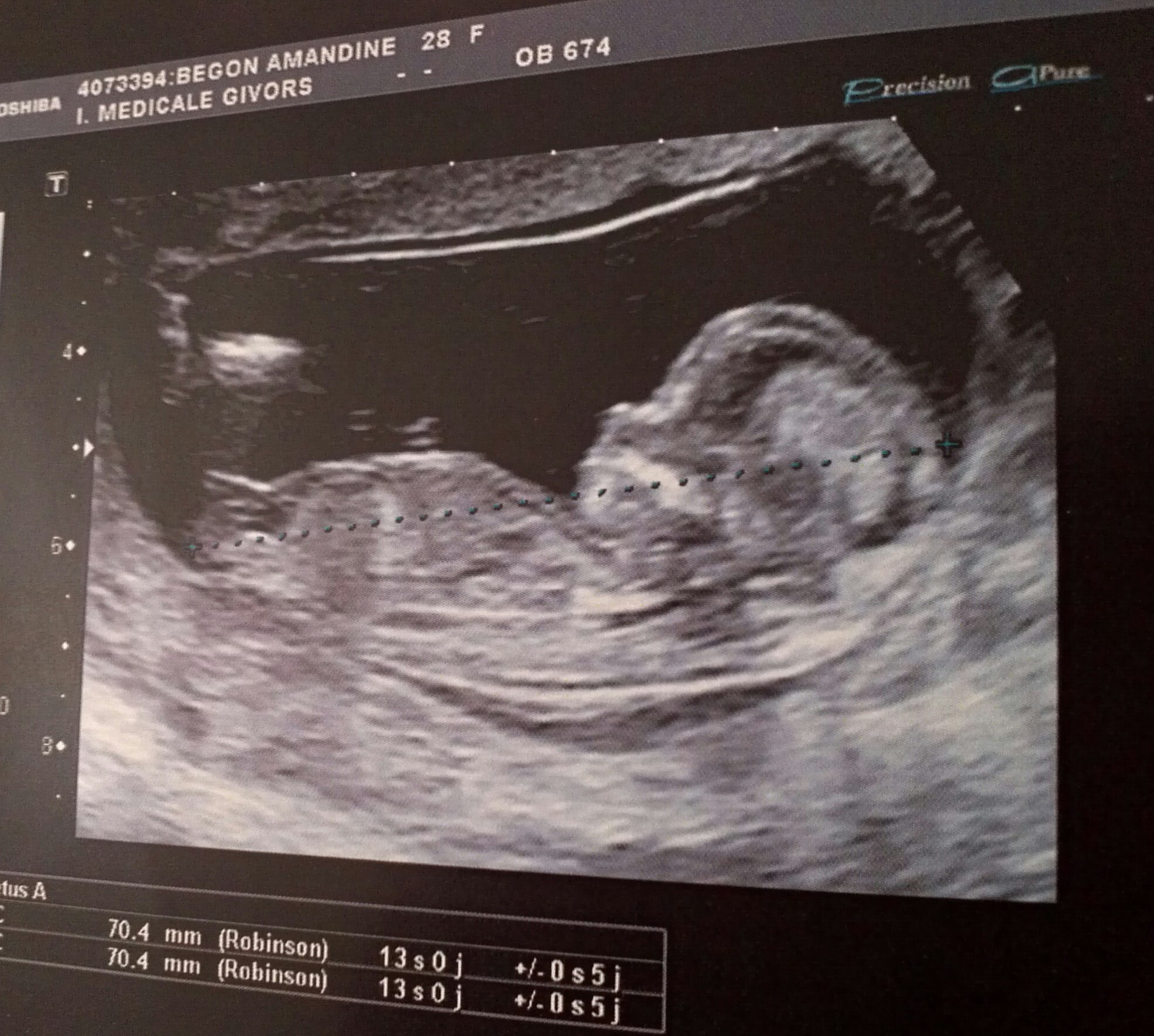 13 Sa Fille Ou Garcon Echographie Connaitre Le Sexe De Votre Bebe Forum Grossesse Amp Bebe Doctissimo 13 Sa Fille Ou Garcon Echographie Connaitre Le Sexe De Votre Bebe Forum Grossesse Amp Bebe Doctissimo