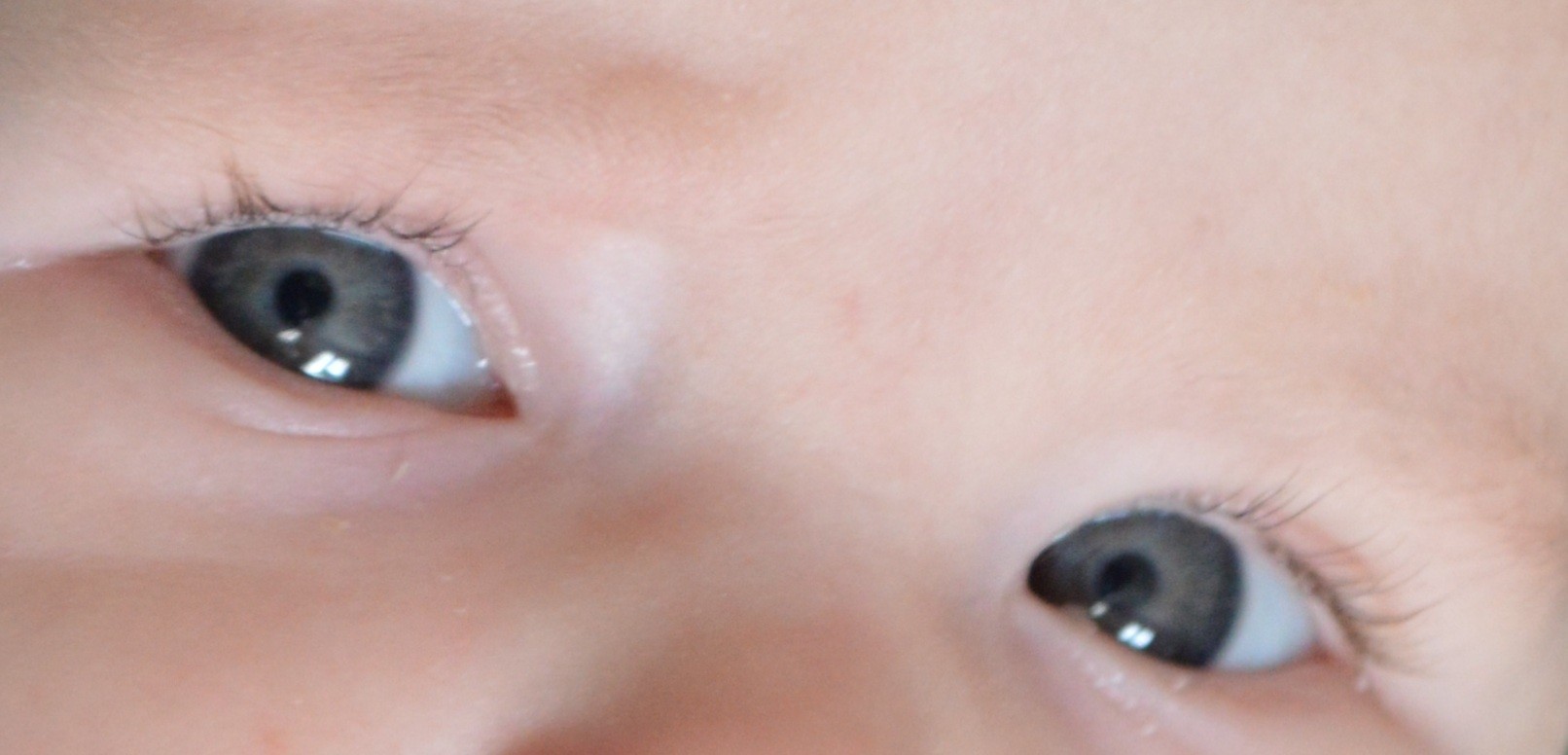 Yeux De Bebe Page 2 Bebe Grandit Forum Grossesse Amp Bebe Doctissimo Yeux De Bebe Page 2 Bebe Grandit Forum Grossesse Amp Bebe Doctissimo