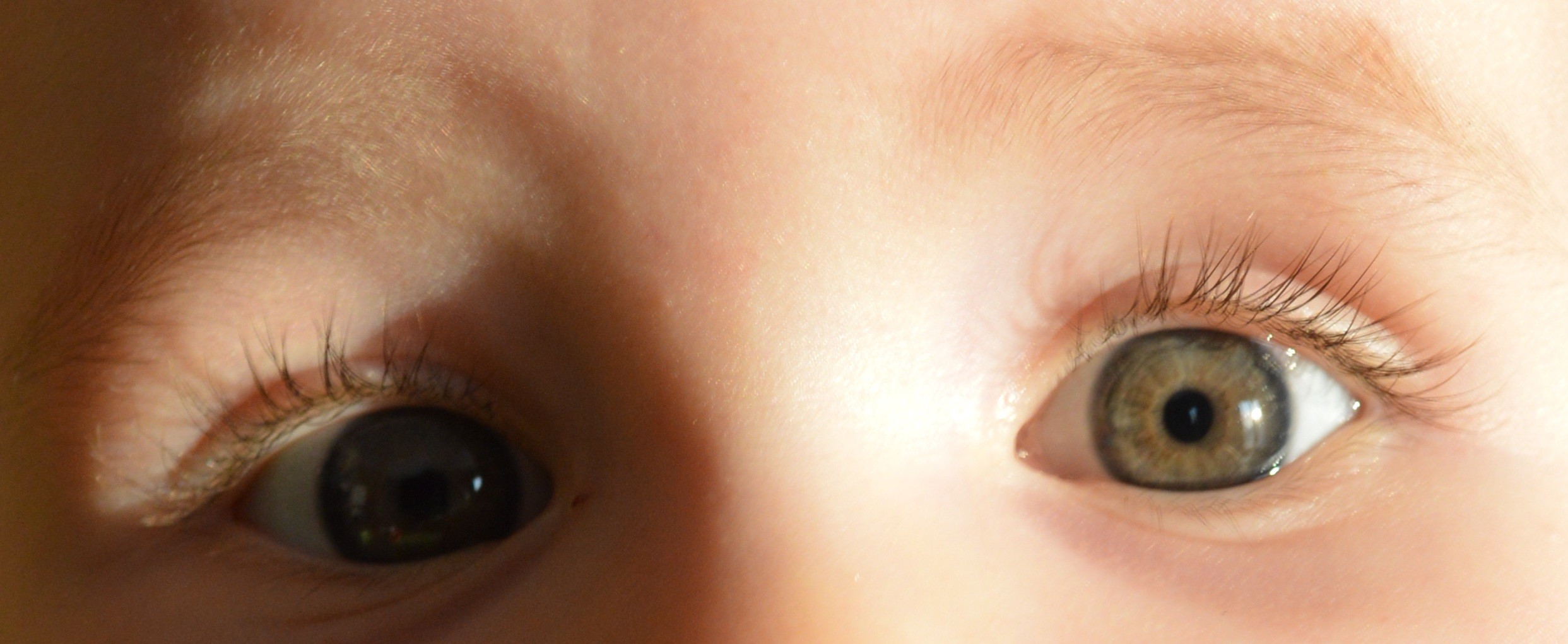Couleur Yeux Bebe 5 Mois Papa Yeux Bleus Maman Yeux Marrons Verts Page 2 Developpement De L Enfant Forum Grossesse Amp Bebe Doctissimo Couleur Yeux Bebe 5 Mois Papa Yeux Bleus Maman Yeux Marrons Verts Page 2 Developpement De L Enfant Forum Grossesse Amp Bebe Doctissimo