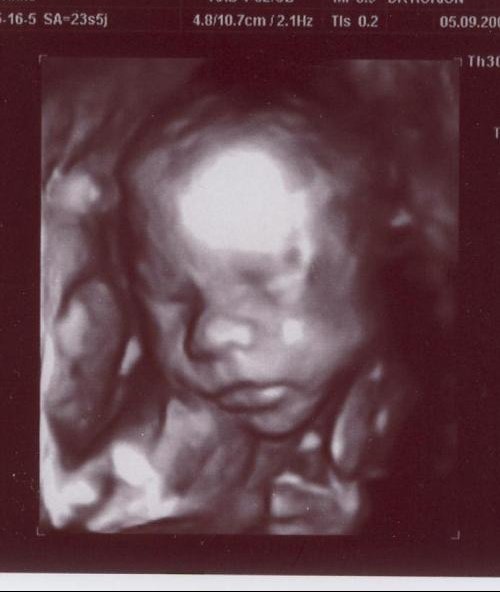 Post Pour Montrer Votre Echo 3d Echographie Connaitre Le Sexe De Votre Bebe Forum Grossesse Amp Bebe Doctissimo Post Pour Montrer Votre Echo 3d Echographie Connaitre Le Sexe De Votre Bebe Forum Grossesse Amp Bebe Doctissimo