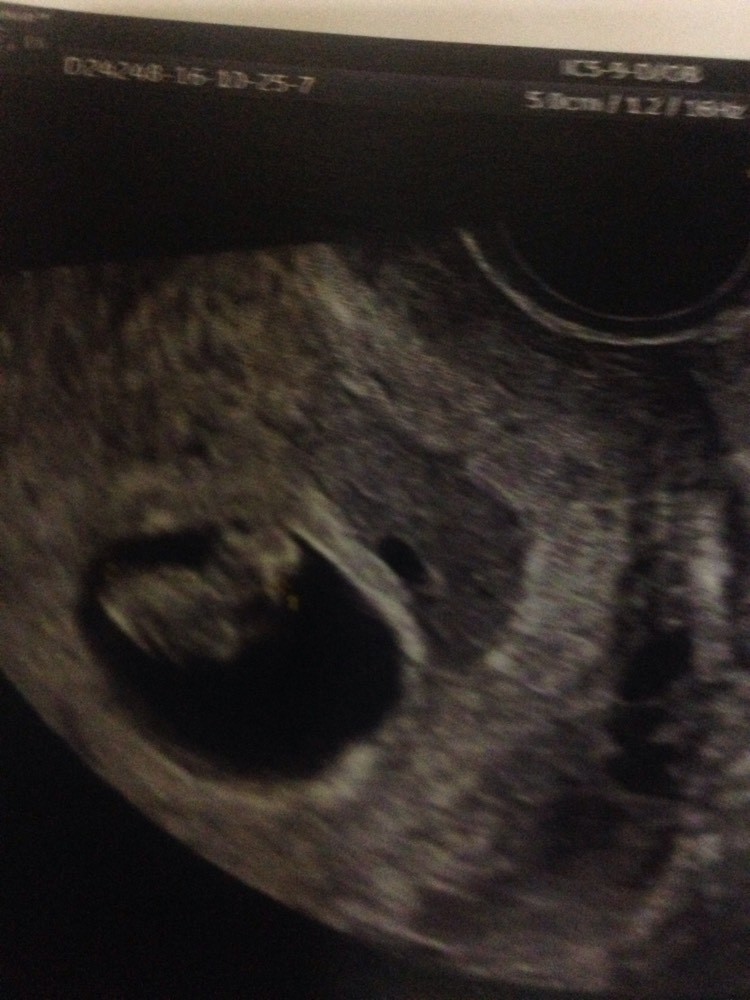 Echo 7sa Echographie Connaitre Le Sexe De Votre Bebe Forum Grossesse Amp Bebe Doctissimo Echo 7sa Echographie Connaitre Le Sexe De Votre Bebe Forum Grossesse Amp Bebe Doctissimo