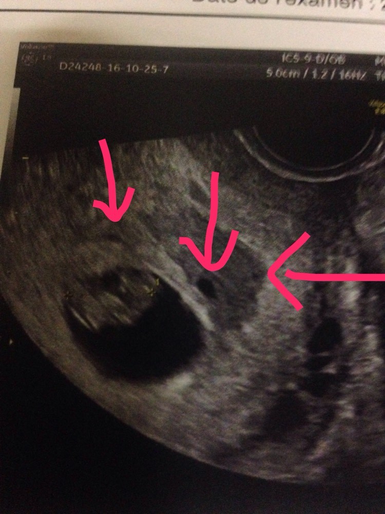 Echo 7sa Echographie Connaitre Le Sexe De Votre Bebe Forum Grossesse Amp Bebe Doctissimo