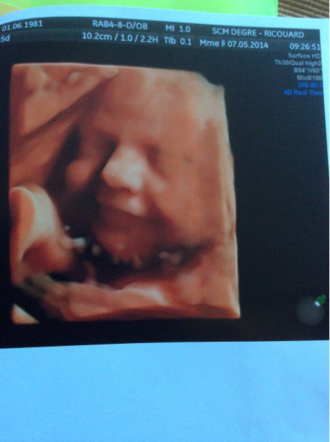Vos Avis Sur Mon Echo 3d Du Dernier Trimestre Futures Mamans Forum Grossesse Amp Bebe Doctissimo Vos Avis Sur Mon Echo 3d Du Dernier Trimestre Futures Mamans Forum Grossesse Amp Bebe Doctissimo